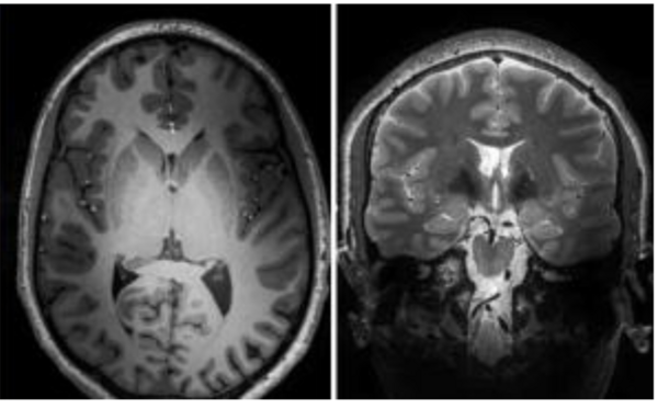 [Translate to Svenska:] MRI