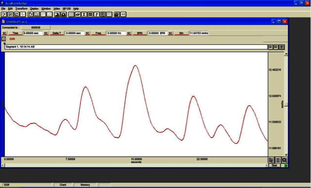 A figure showing electrophysiological responses with a curve of peaks and lows